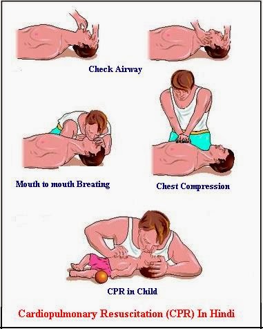 Cpr Chart In Hindi