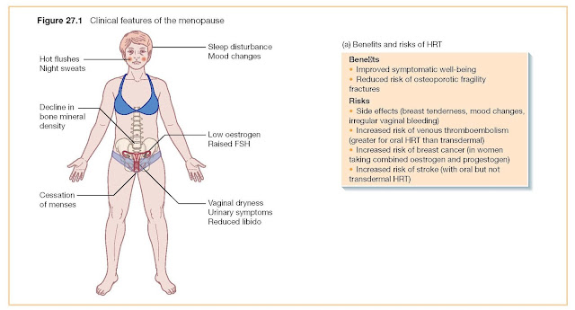 MENOPAUSE AND HRT