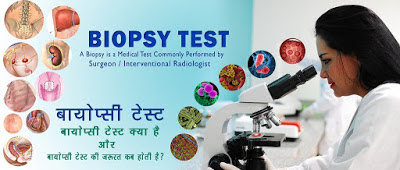 बायोप्सी टेस्ट Biopsy Test in Hindi BIOPSY-TEST-IN-HINDI, BIOPSY-Hindi-TIPS, BIOPSY-kya-hai, biopsy-procedure-in-hindi, biopsy-test-kaise-hota-hai, Biopsy jankari