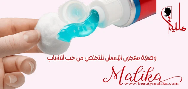 وصفة معجون الأسنان للتخلص من حب الشباب وصفة معجون الأسنان للتخلص من حب الشباب