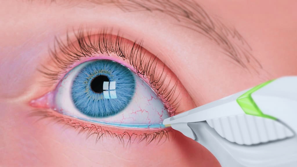 Eyes Disease and Treatment of Eyes Disease