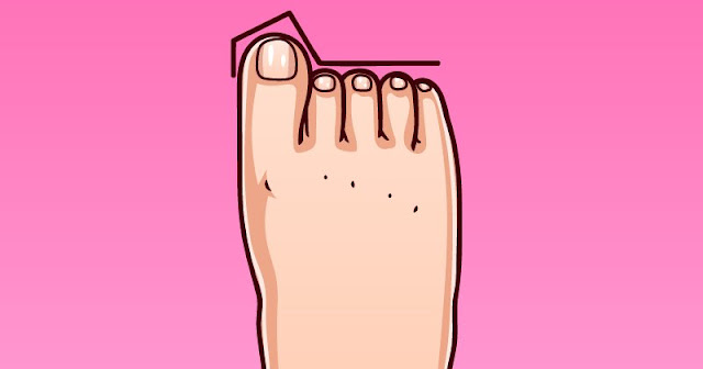 Types Of Feet