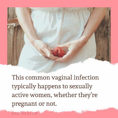 vaginal itching