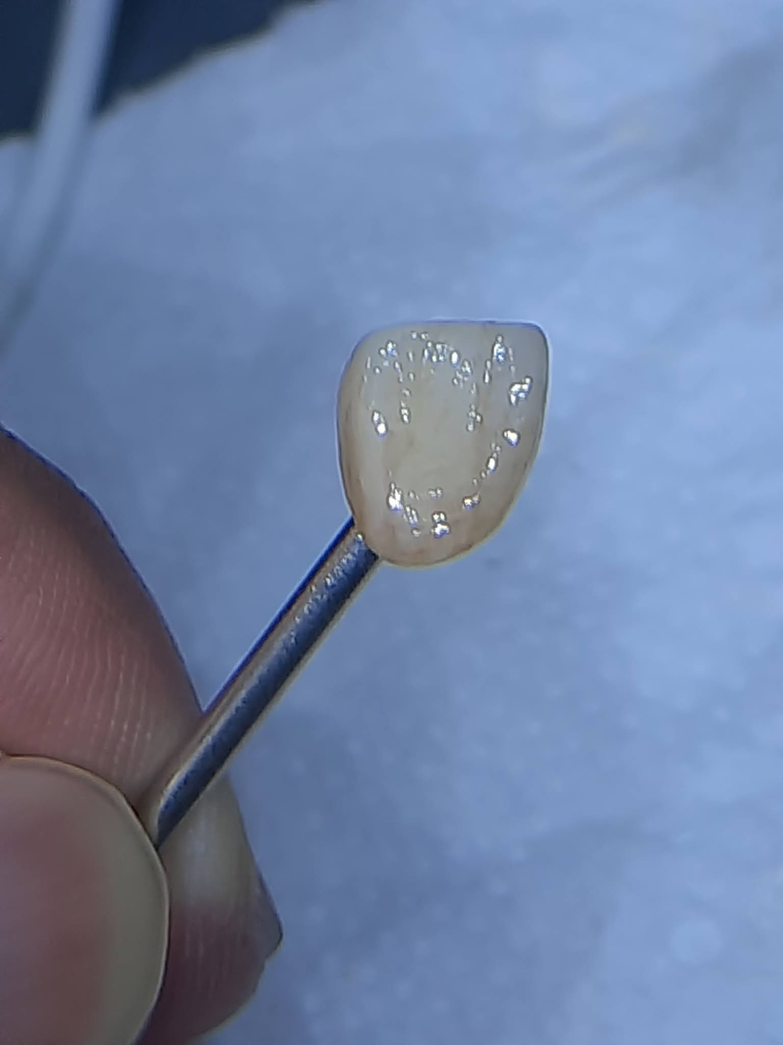 Zirconia Staining and Glazing Pinoydental