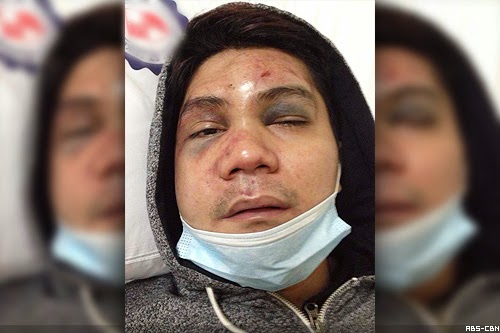 The camp of Vhong Navarro confirms to file cases against Vhong's attackers