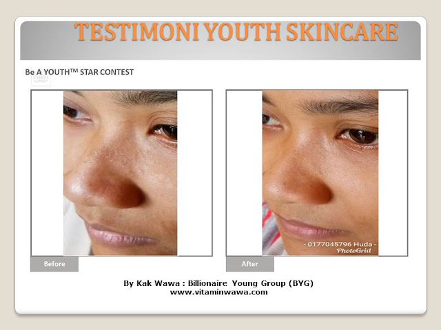 34 Testimoni Youth Skincare Shaklee Terbaru, Youth skincare shaklee, testimoni youth skincare shaklee, Youth Skincare Shaklee : Harga dan Review Pengguna Youth Shaklee, testimoni youth skincare shaklee, testimoni youth skincare shaklee 34 Testimoni Youth Skincare Shaklee Terbaru, Youth skincare shaklee, testimoni youth skincare shaklee, Youth Skincare Shaklee : Harga dan Review Pengguna Youth Shaklee, testimoni youth skincare shaklee, testimoni youth skincare shaklee
