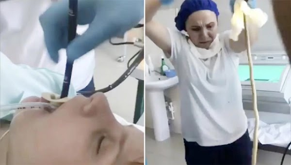 Merinding! Video Dokter Keluarkan Ular 1,2 Meter dari Mulut Wanita