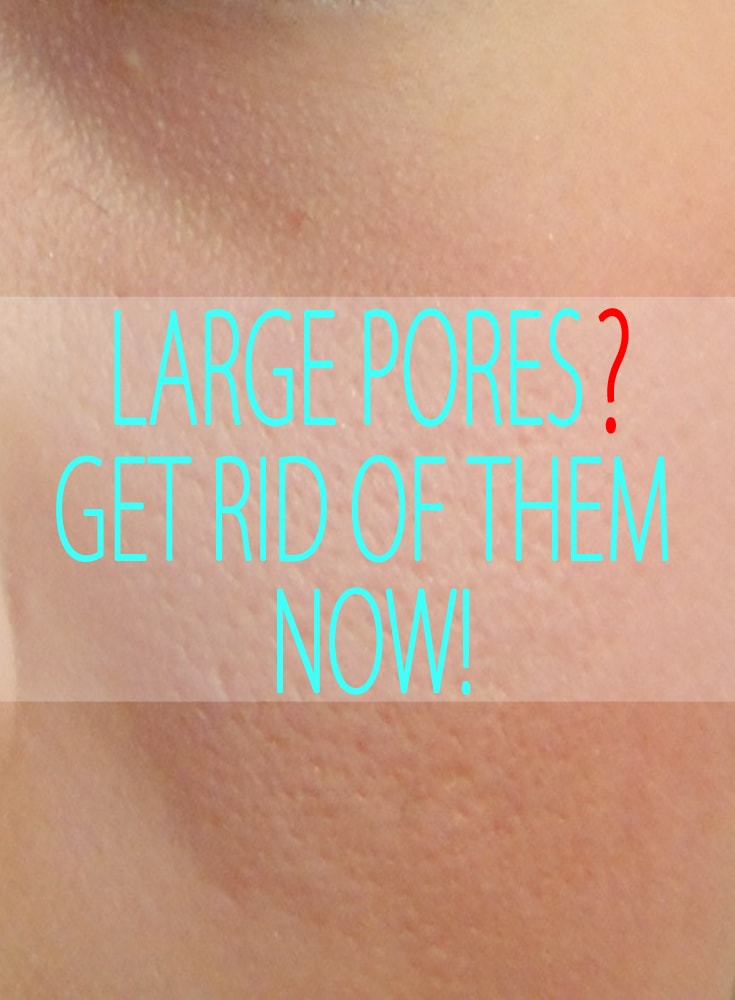 Get Rid Of Large Pores On Face By Using Home Remedies Natural remedies