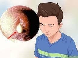 kencing sakit dan perih keluar seperti nanah kencing sakit dan perih keluar seperti nanah