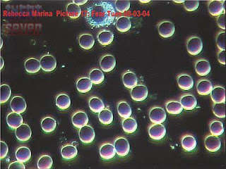 Sebuah Penelitian yang Mengejutkan Ternyata Darah Manusia bisa Bereaksi ketika Kita sedang Berdoa,Sedih,Takut dan Jatuh Cinta Sebuah Penelitian yang Mengejutkan Ternyata Darah Manusia bisa Bereaksi ketika Kita sedang Berdoa,Sedih,Takut dan Jatuh Cinta