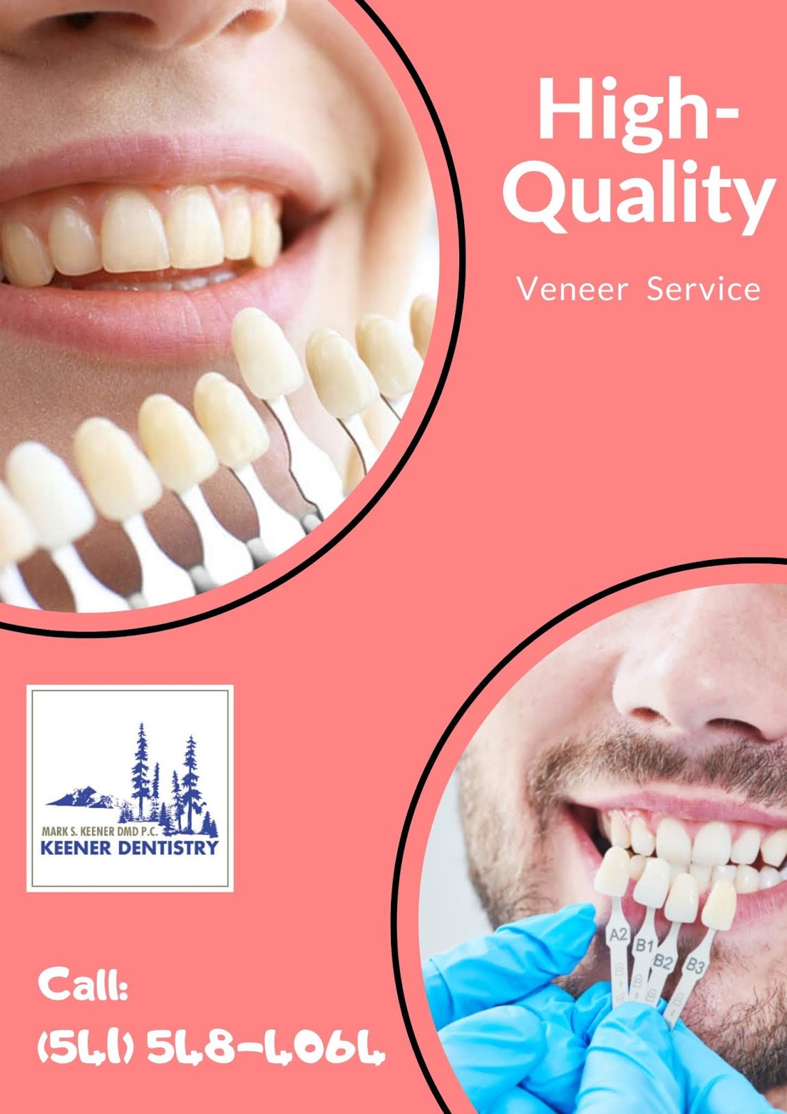 HighQuality Veneer Service