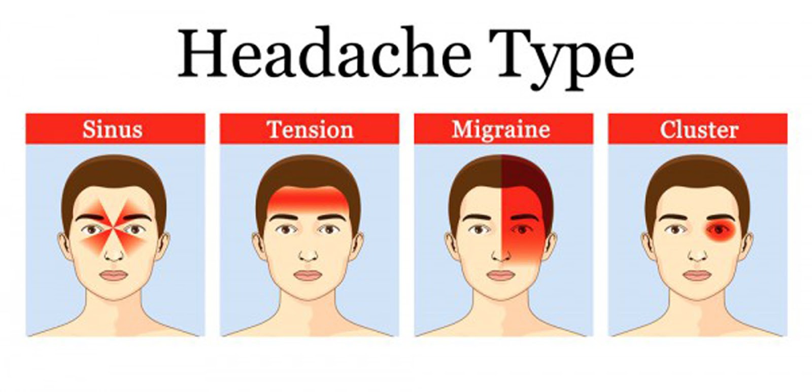 Постоянно болит лоб. Виды головной боли. Вилюды, головной боли. Типы головной боли и причины. Головная боль в лобной части головы.