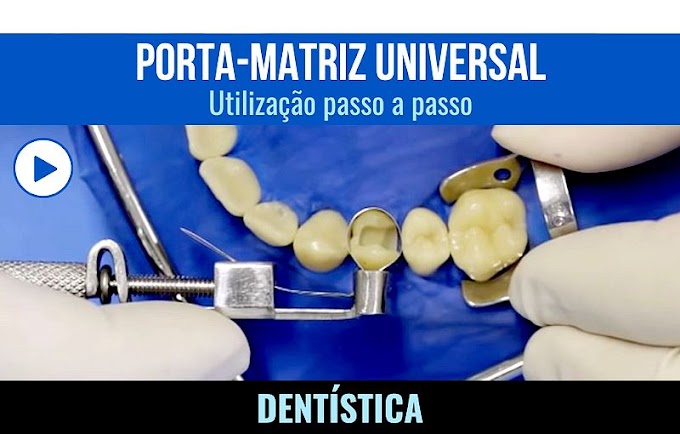 PORTA-MATRIZ UNIVERSAL: Utilização passo a passo