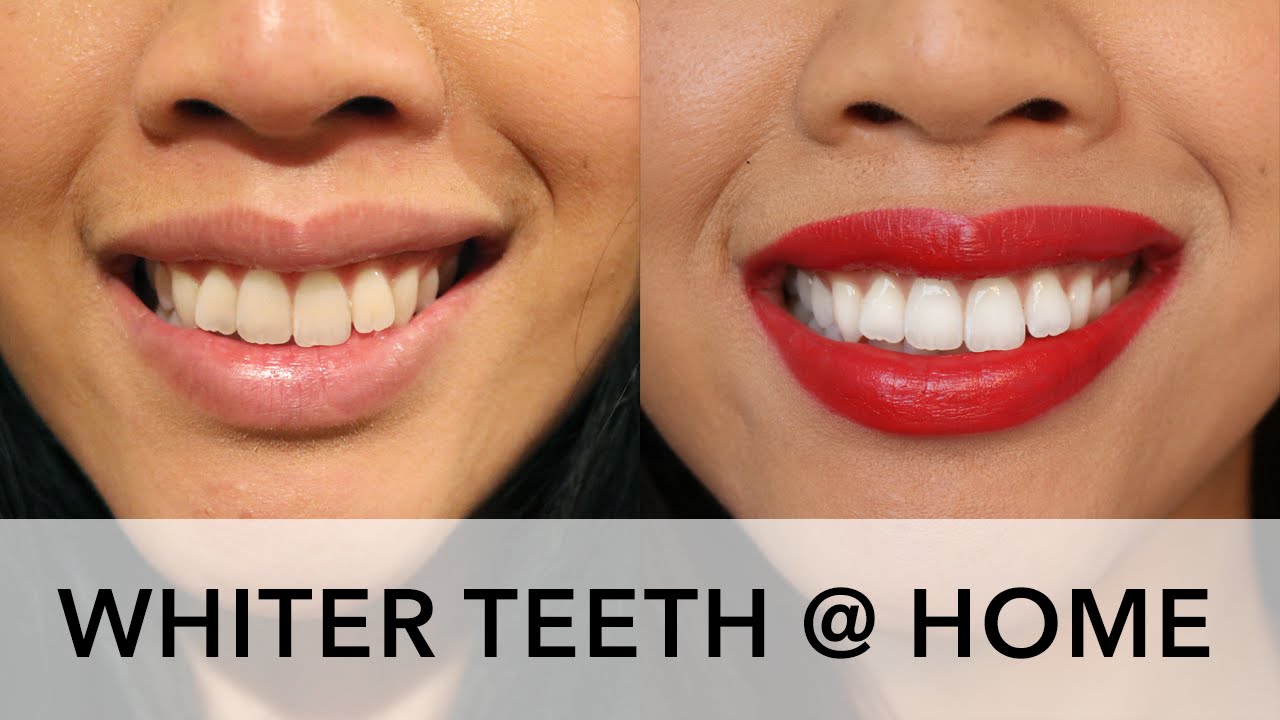 How To ______ Here are simple ways you can naturally whiten your teeth.