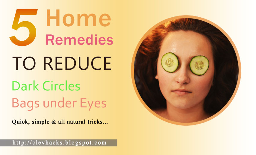 5 Home Remedies for Dark Circles and Bags under Eyes ClevHacks
