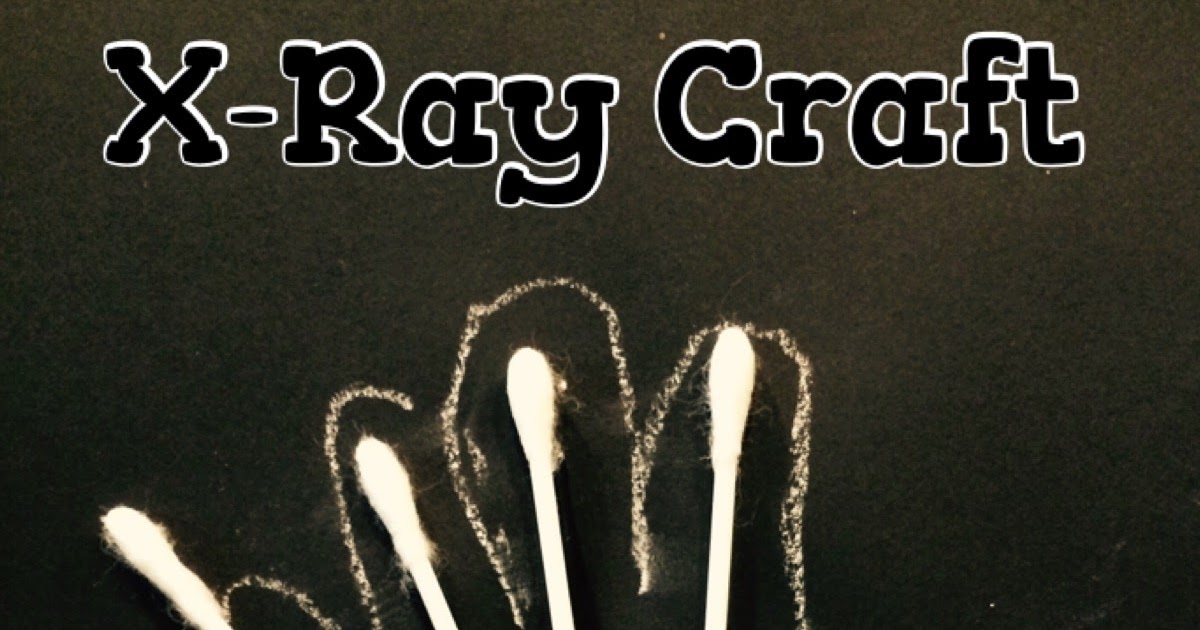 Letter X XRays Craft, XRay Match, XRay Light Box (Day 2)