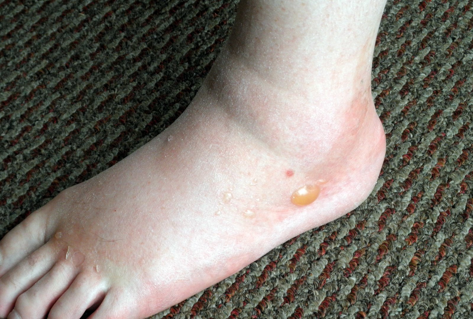 Marquesa of Mayook Attack Of The YellowJacket Wasp