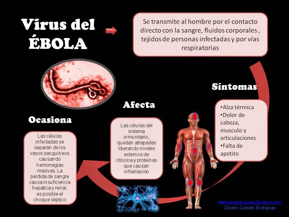 Lara en Noticias: Brotes del virus Ébola puede alcanzar hasta un 90% de ...
