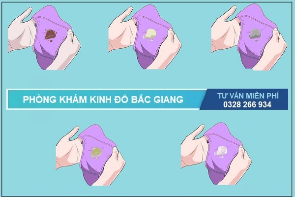 Khí hư bất thường do đâu?