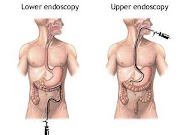 ENDOSCOPIC PROCEDURES - by Sahaj Gastro & Liver Clinic