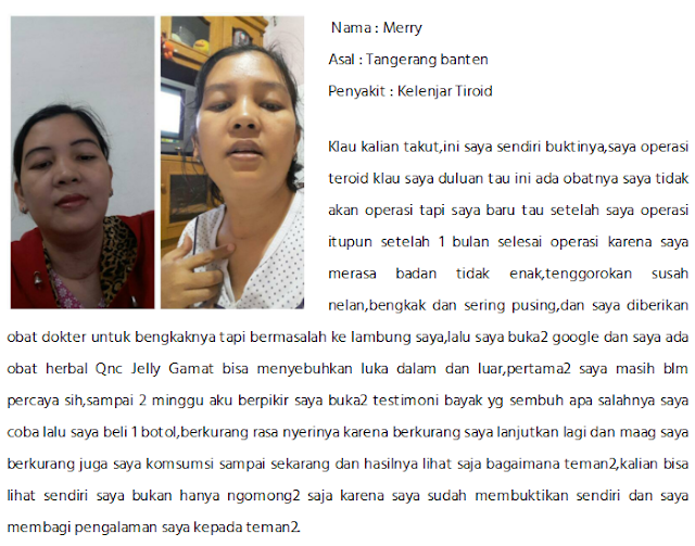 Cara Menghilangkan Kelenjar Getah Bening Pada Anak Mujarab Cara Menghilangkan Kelenjar Getah Bening Pada Anak Mujarab