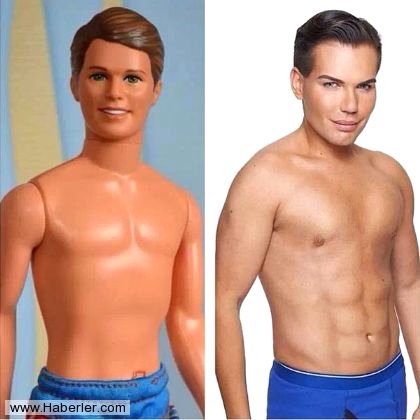 Real Life Ken Doll Before And After