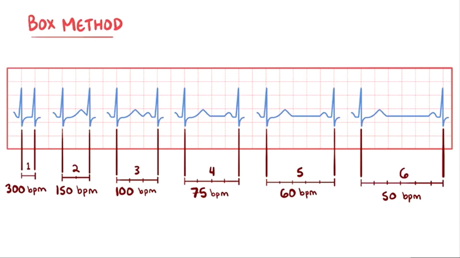 Ekg Ders 3 Nabiz Hizi Hesaplama Ve Duzensiz Ritmi Tanima