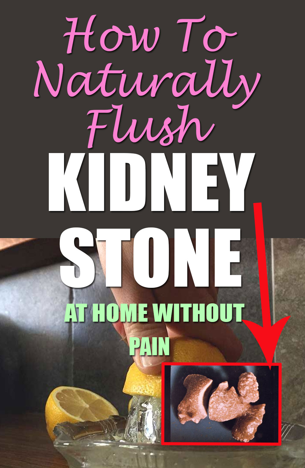 How To Naturally Flush Kidney Stones