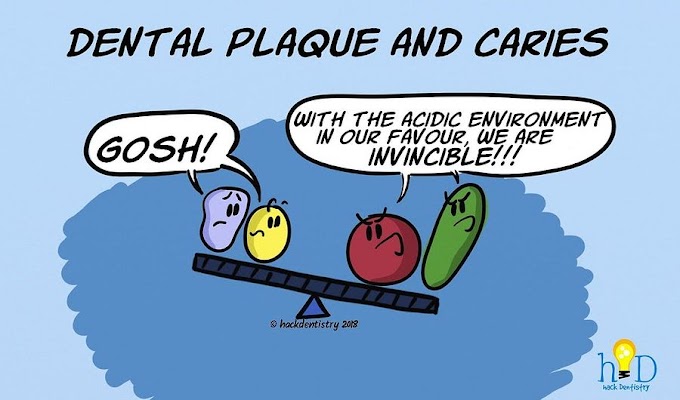 ORAL HEALTH: Dental plaque and Caries - Plaque formation and it's role in causing dental caries