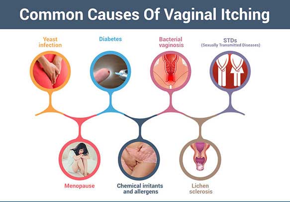 Vaginal Itching - Home Remedies For Vaginal Itching-8215