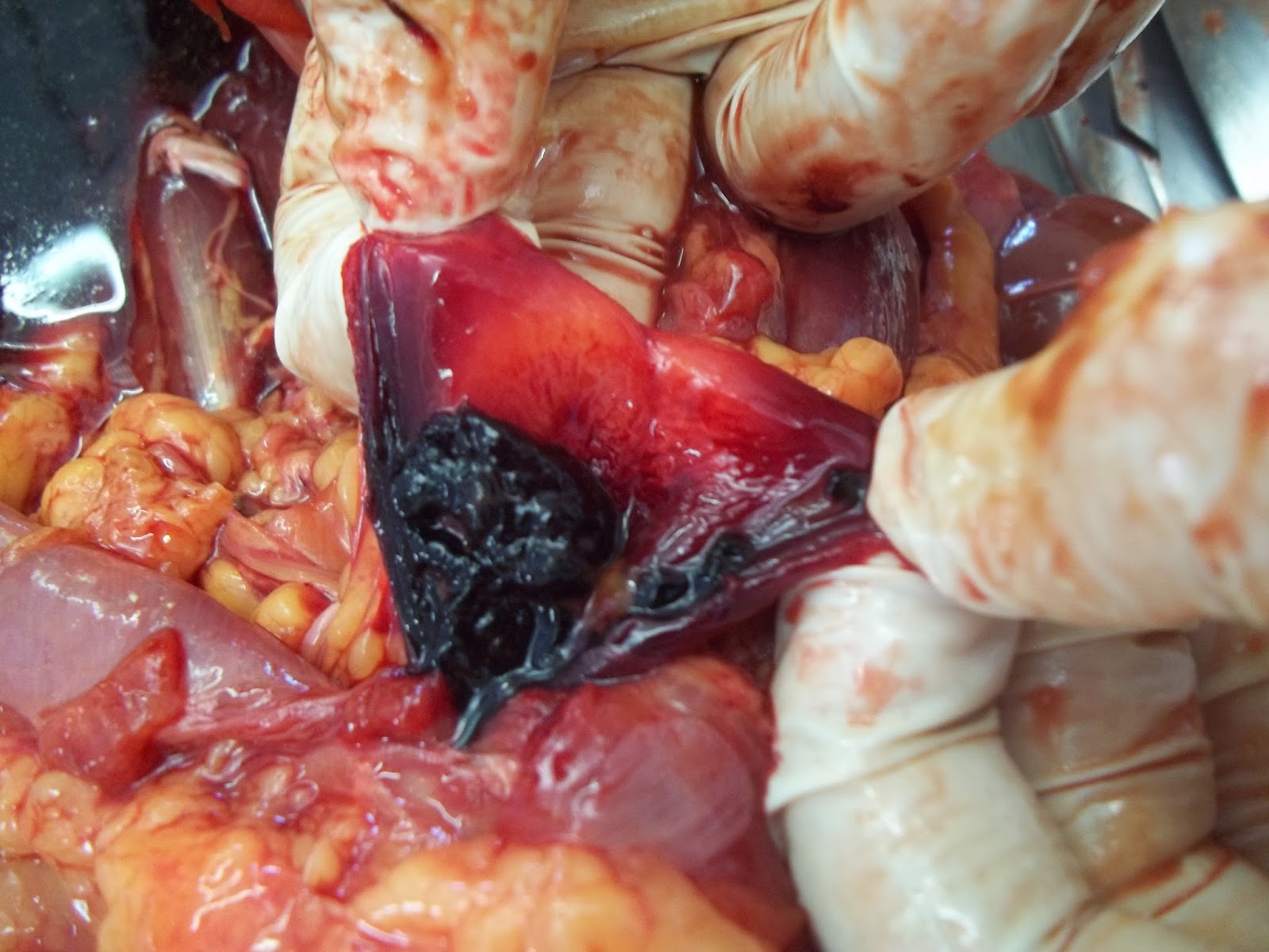 Patologia Veterinária: Hemorragia na bexiga de um cão.