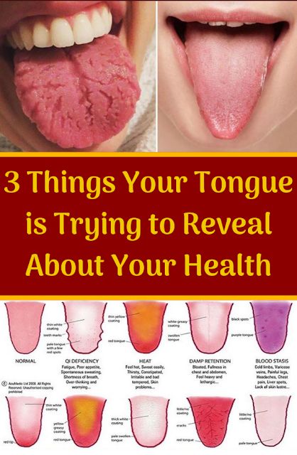 The Amazing Secrets That Your Tongue Can Reveal About Your Health - abilenebeuty.blogspot.com
