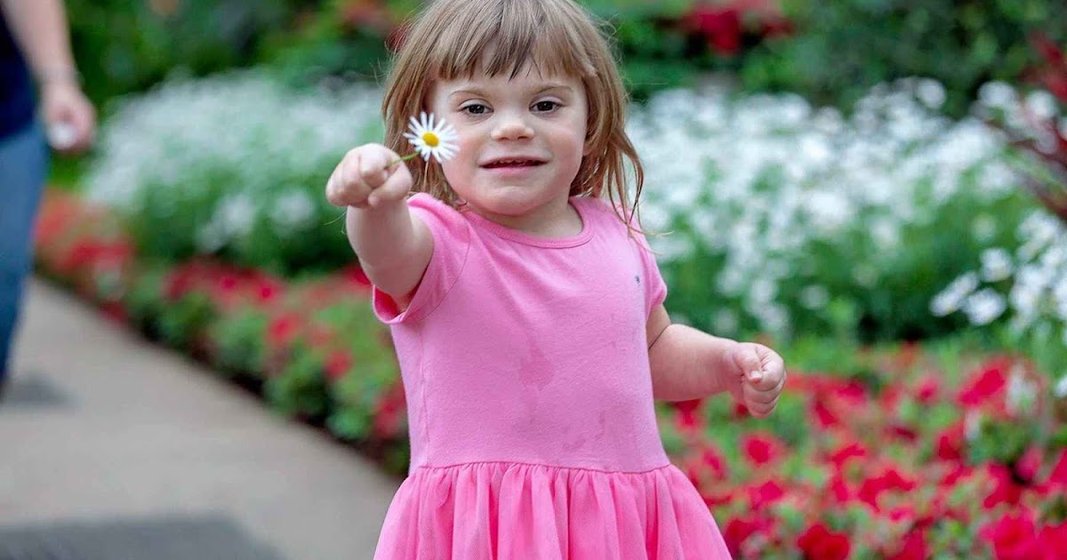 Overview and symptoms of Turner syndrome
