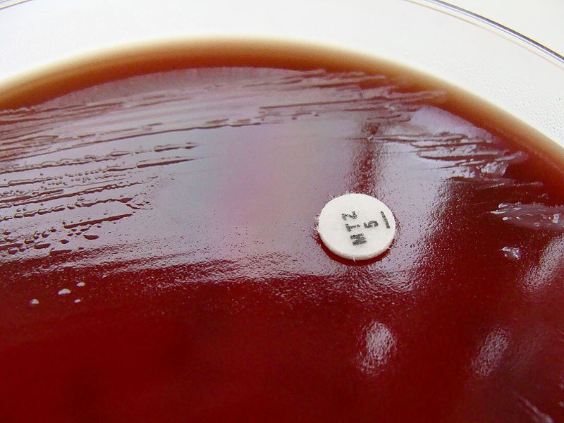 Medical Laboratory and Biomedical Science Should anaerobes be cultured