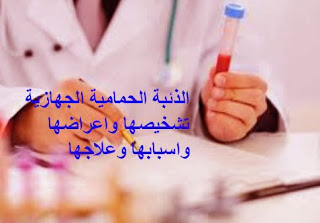 الذئبة الحمامية الجهازية  تشخيصها واعراضها واسبابها وعلاجها والمضاعفات