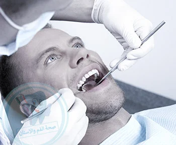 مسح استخراج المولي