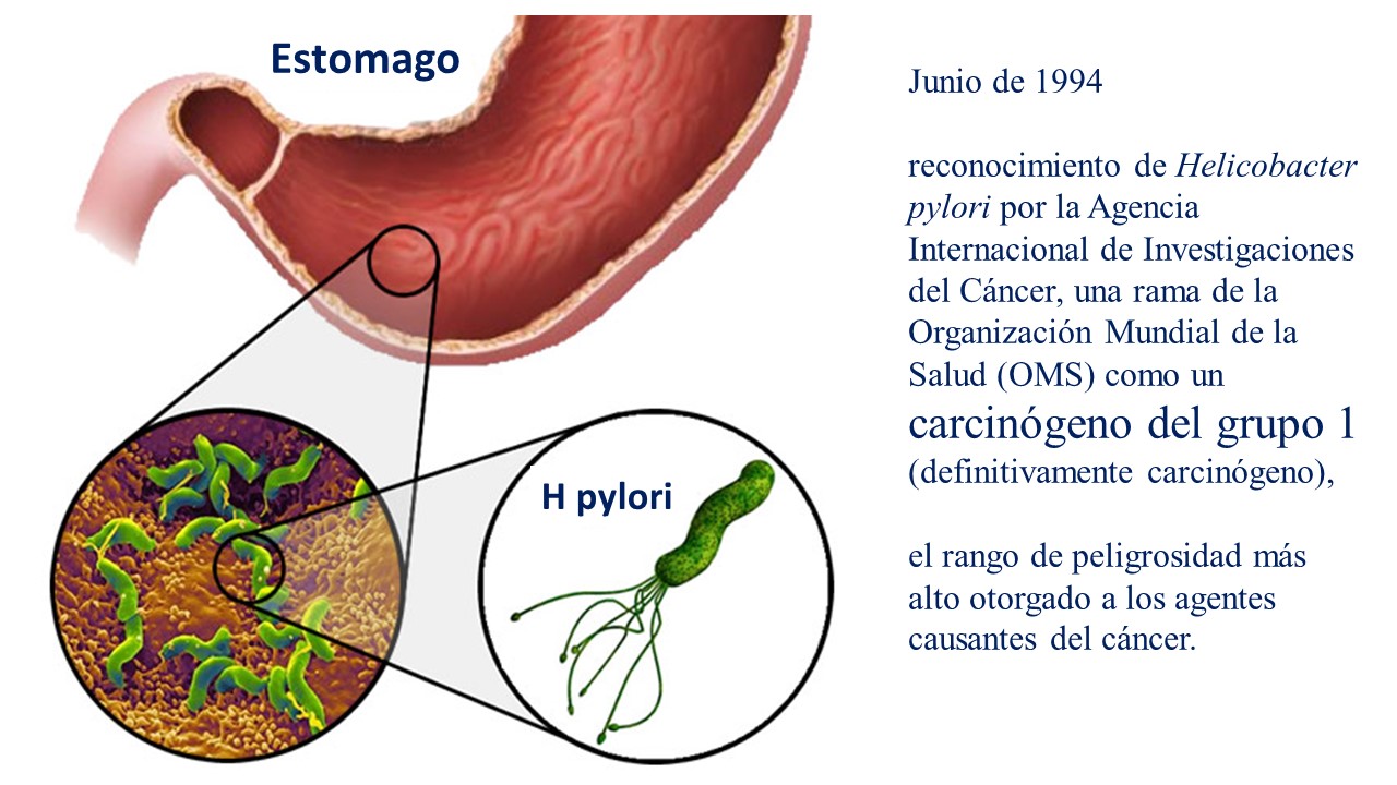 Helicobacter pylori sintomas piel