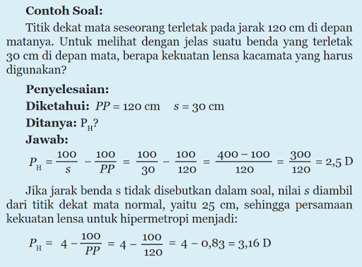 Materi Cahaya dan Optik Part 8 Rabun Dekat dan Rabun Materi Cahaya dan Optik Part 8 Rabun Dekat dan Rabun