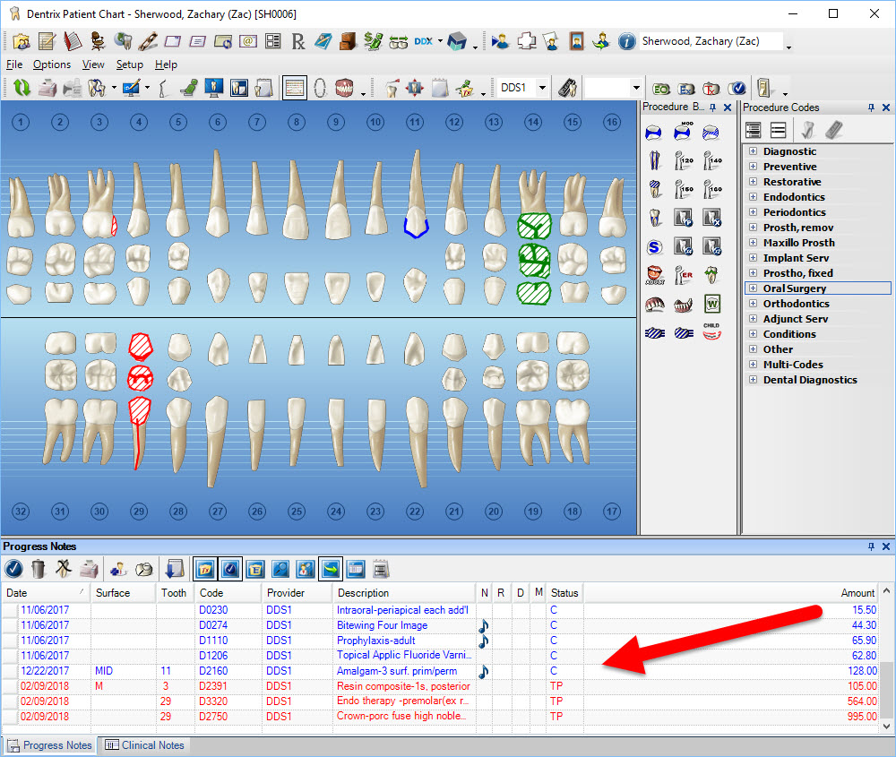 How To Chart Supernumerary Teeth In Dentrix
