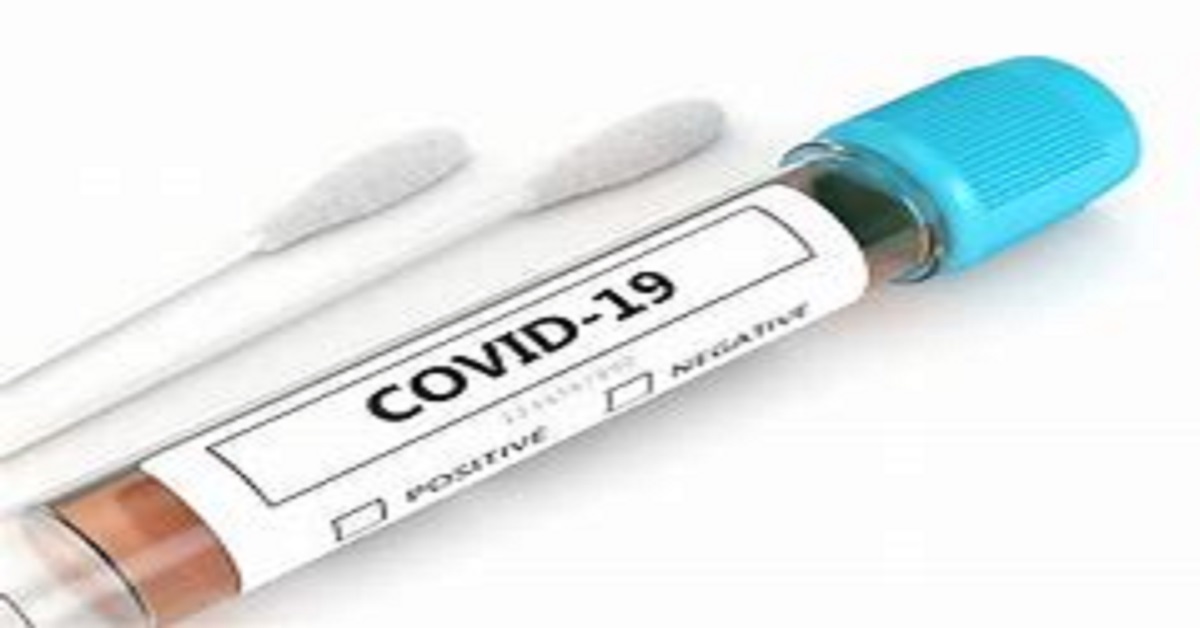 Shillong Municipal Board’s representatives to experience COVID19 test on Saturday