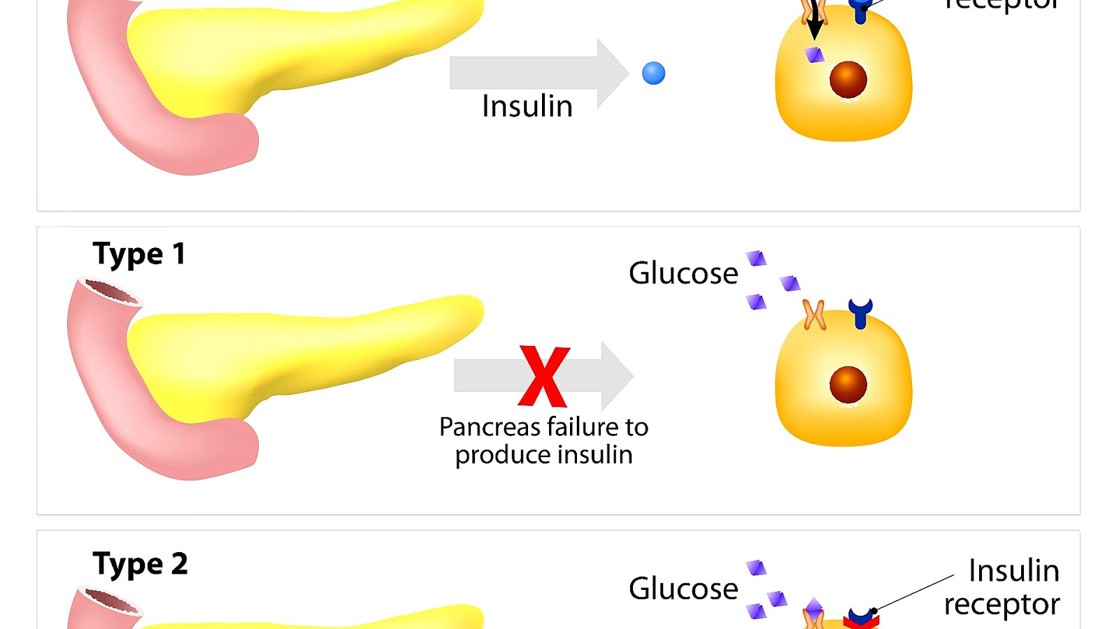 A Liver Cell Responds To Insulin By - Insulin Choices