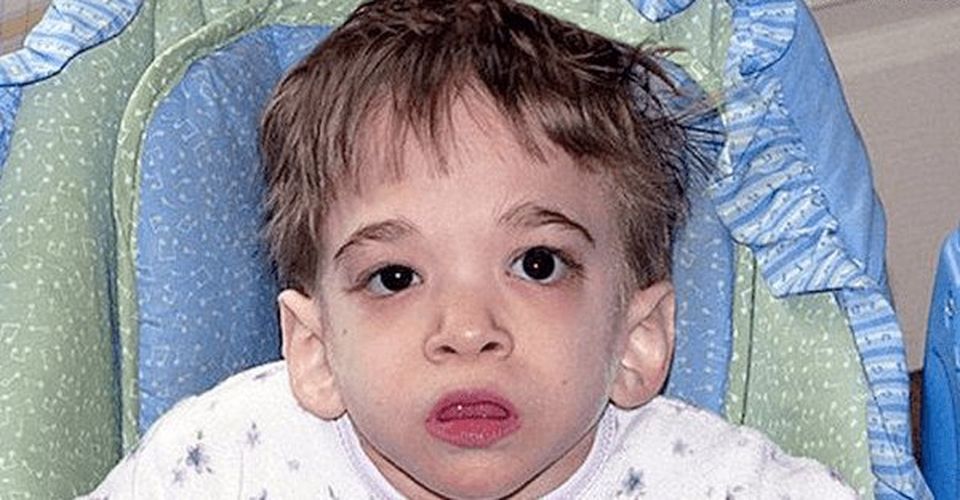 SYNDROME X ( Why aging wasn’t seen ?)