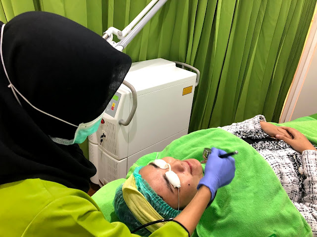 ZAP PHOTO FACIAL GLOW ZAP PHOTO FACIAL GLOW