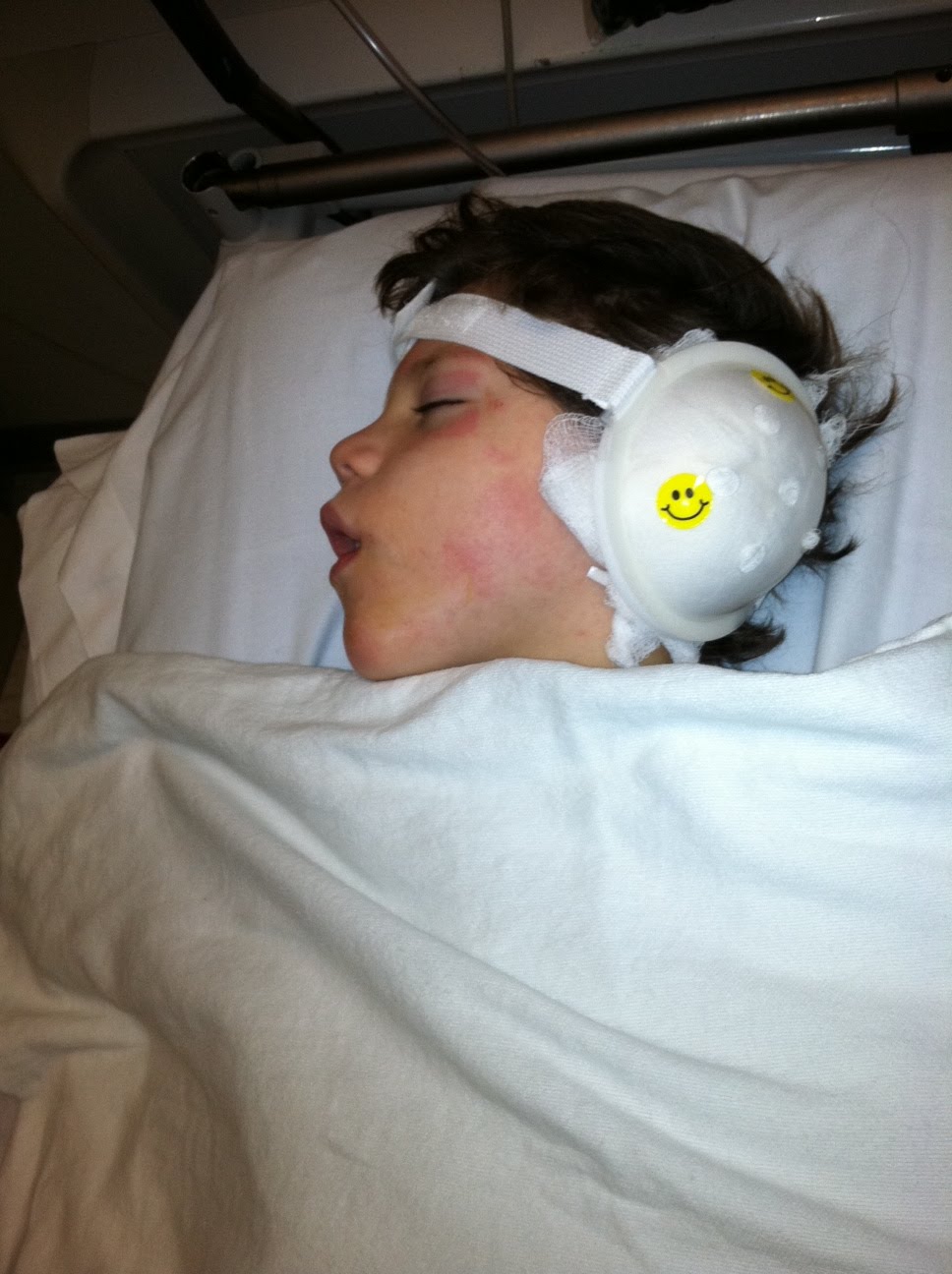 Let's Fill the Van! Cochlear Implant Surgery GRAPHIC picture WARNING