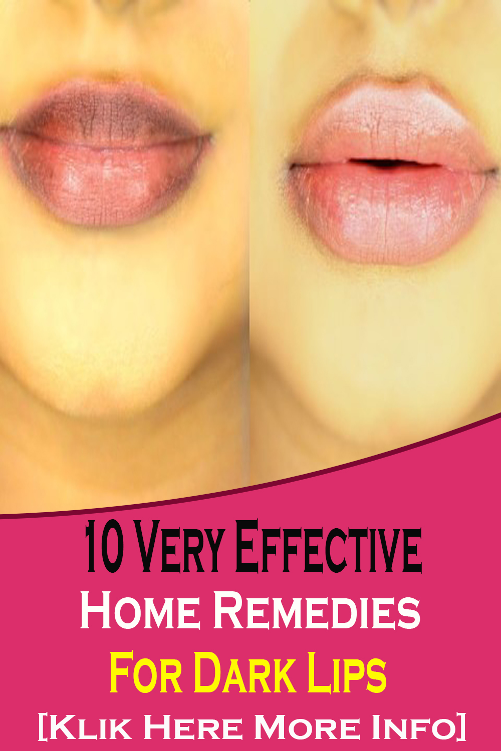 10-very-effective-home-remedies-for-dark-lips-the-pins-populer-2