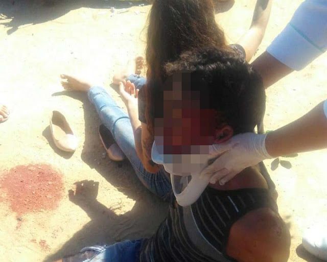 Colisão frontal entre motos deixa três feridos em Jacobina