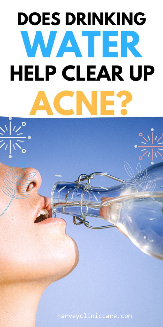 How Does Drinking Water Help Acne Scars? Healthy Lifestyle