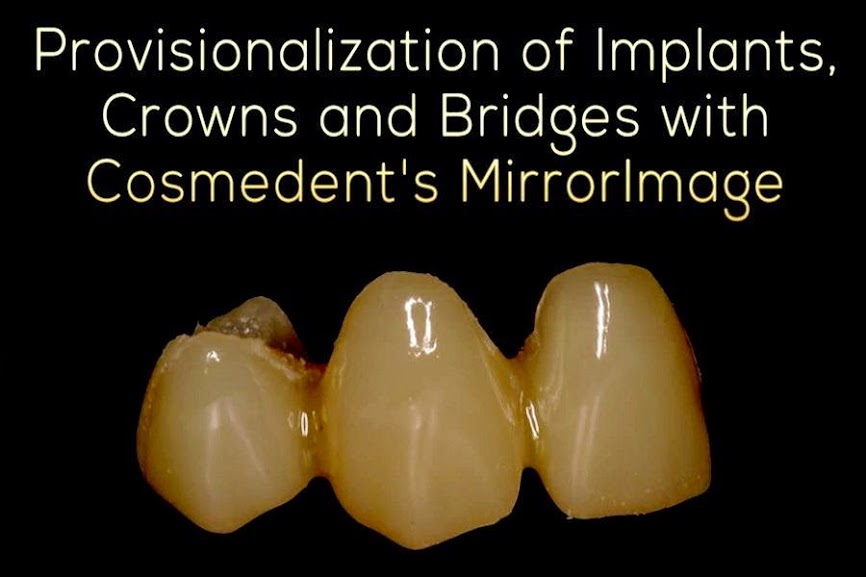 PROSTHODONTICS Temporary Dental Bridge