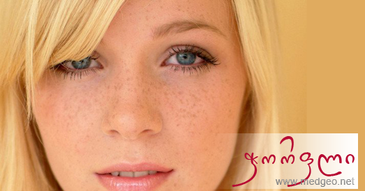 ჭორფლი სახეზე