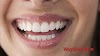 Important 10 steps for maintaining good dental and oral hygiene | Way2health